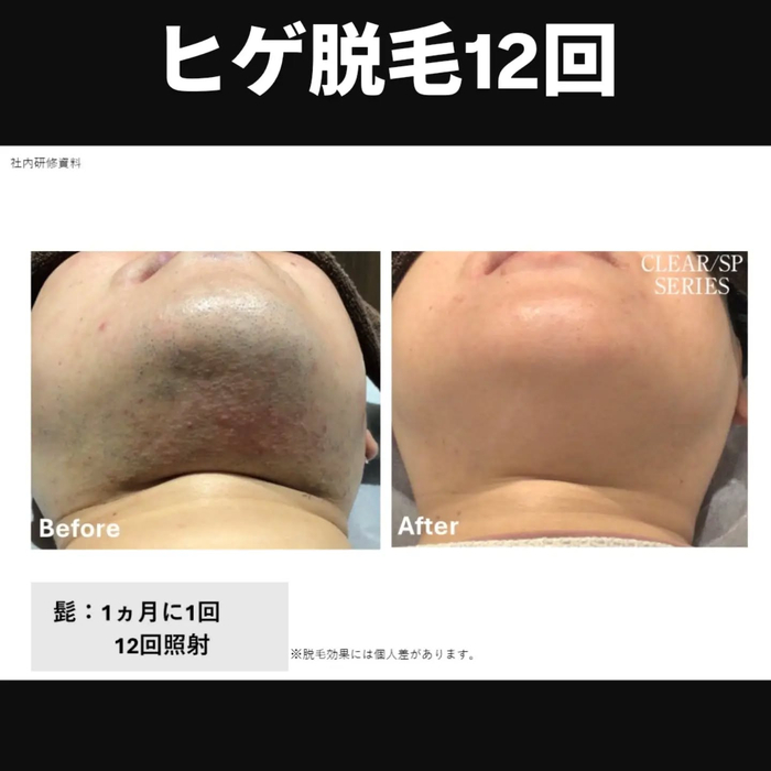 画像488